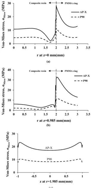 Fig. 7. Von-Mises stress (σ Mises ) distribution in the cross-section of a PMMA ring substrate restored by Clearfil AP-X resin 