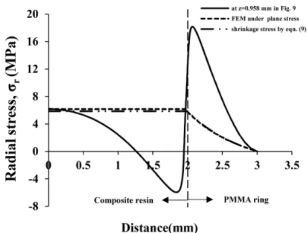 Fig. 10. Behaviors of radial stresses σ r  distributed on the surface of the AP-X composite resin-restored PMMA ring specimen  