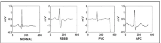 Figure 3 shows an MLP classifier with an input, hidden, and output layer for classifying four different arrhythmias.