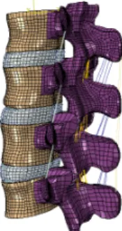 Fig. 1  Intact Model.