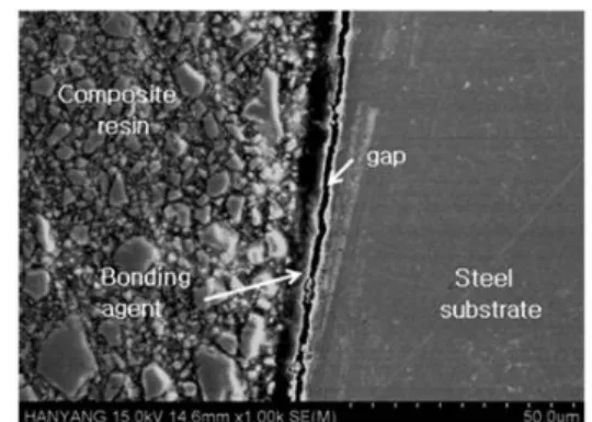 Fig. 6  The circumferential strain of the ring substrate during the polymerization  shrinkage of the composite resin.