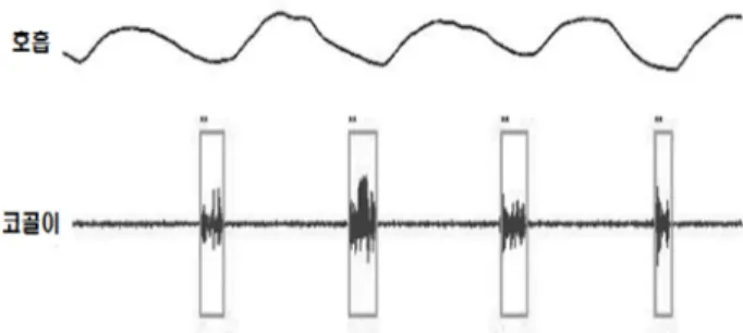 Fig. 8. Structure for extracting heart rate signal