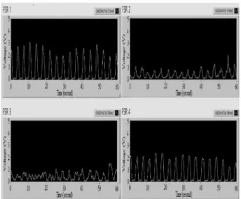 Fig. 8. Respiration signals when the head was right to the ceiling and the snoring occurred.