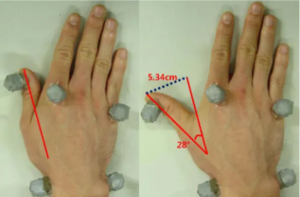 Fig. 8. Development of a cuff.