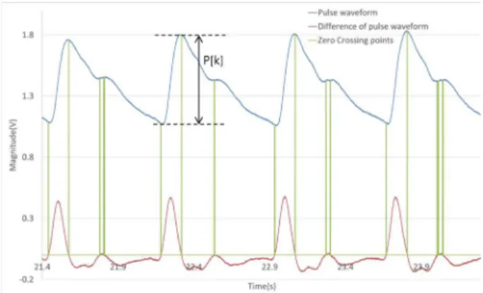 Fig. 6. Example of working mechanism of the tonometry sensor to find the proper pressurization angles (q 4 ) rotated along the axis T.