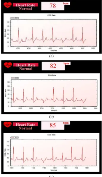 Fig. 11. ECG outputs according to the distance conditions, such as (a) 10 cm, (b) 20 cm, and (c) 30 cm