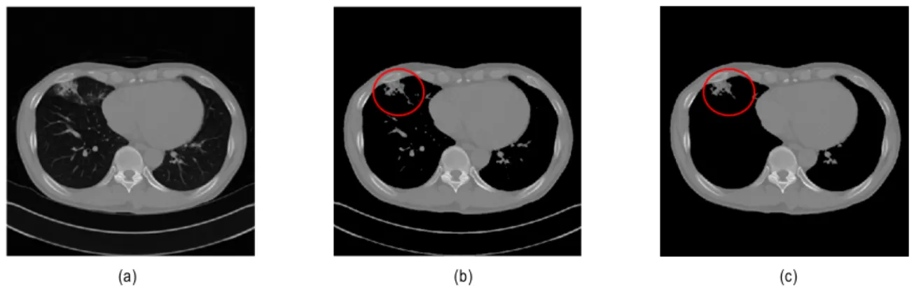 Fig.  3.    Airway  and  lung  segmentation  flow  chart