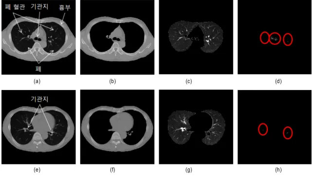 Fig.  8.  기관기 분할 (a)  원 영상,  (a)  영역성장법 적용 결과 (c)  폐 및 기관지 영상 (b)  기관지 영상