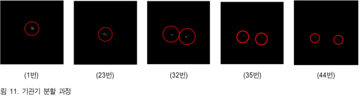 그림 11.  기관기 분할 과정