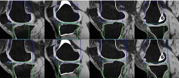 Fig.  5.  Localization  error  of  bounding  box  regarding  repetitive  learning  of  contextual  information