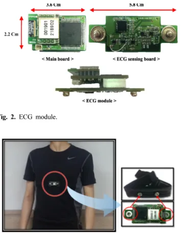 Fig. 4. Block diagram representation of the overall ECG feature extraction.