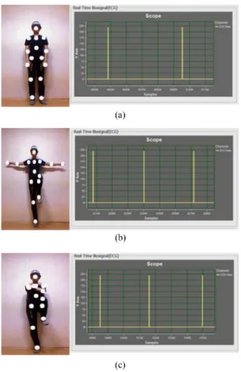 Fig. 12. Squat exercise as physical rehabilitation.