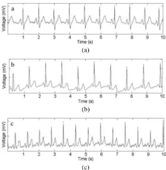Fig. 10. Comparison of the ECG signal with different cotton wool shirt thicknesses; (a) 0.5 mm, (b) 1 mm, and (c) 3 mm.