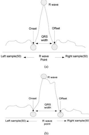 Fig. 4. QRS width; (a) Normal QRS and (b) abnomal QRS.