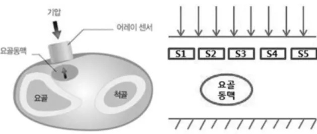Fig. 1. Blood pressure sensing using pressure sensor array.
