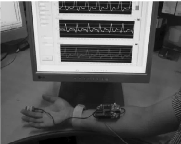 Fig. 13. Pulse wave obtained from developed Hall sensor(top) and