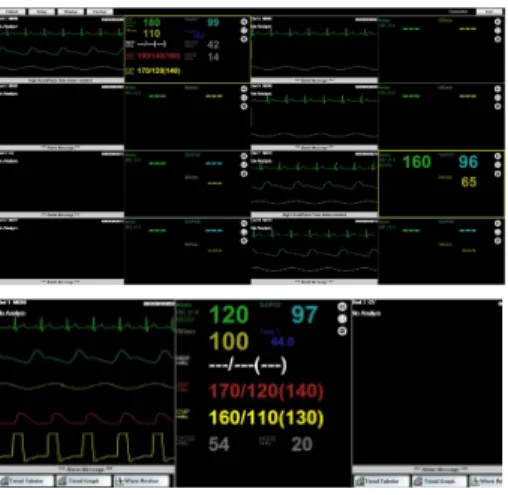 Fig.  3.  CMS's  12  Lead  Data  Screen