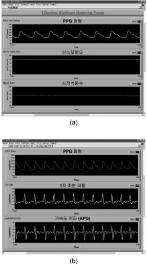 Fig. 9 . LabVIEW monitoring program: (a) wrist type oximeter data, (b) APG waveform.