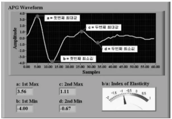 Table 1. Vascular compliance analysis results from real experiments 20 대 여 30 대 남 HR( 회 / 분 ) 77 73 산소포화도 (%) 99 98 변곡점  a 2.37 3.47 변곡점  b − 2.87 − 3.92 b/a − 1.21 − 1.13