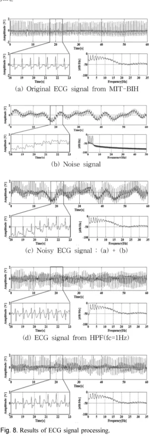 Fig. 8. Results of ECG signal processing.