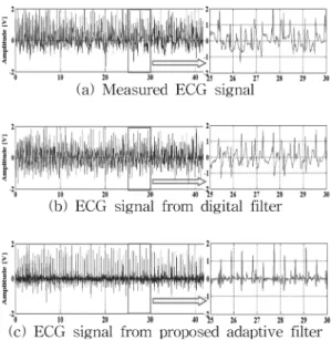Fig. 12. Results of ECG signal processing : 6 km/h.