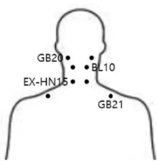 Fig 1. Acupotomy points 