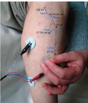 Fig. 1 shows the proximity of the acupoints near to ST-36 on  Participant A, with the relative distances marked in blue