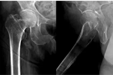 Fig. 3. The change of Harris hip score during hospitalization.