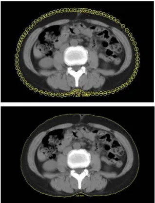 Fig. 3. Waist circumference measurement