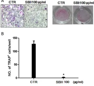 Fig.  1.  Ssangbohwan(SBH)  inhibits  osteoclast  differentiation