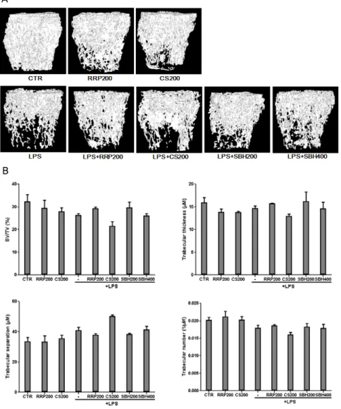 Table 3. Skyscan Analysis of LPS-induced Bone Loss in Mice