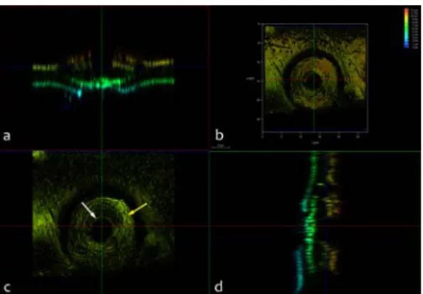 Fig. 4. Bordered pits on the radial cell wall of trache- trache-id of Korean red pine