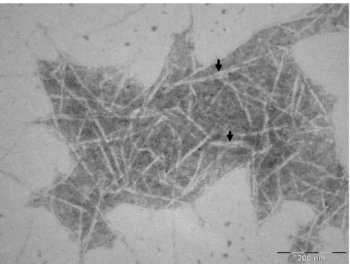 Fig. 1. TEM images of CNFs isolated by TEMPO- Oxidation from HW-BKP. (a) ×60,000, (b) ×100,000.