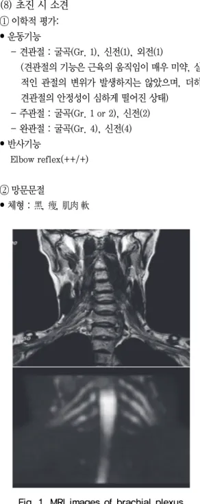 Fig. 1. MRI images of brachial plexus