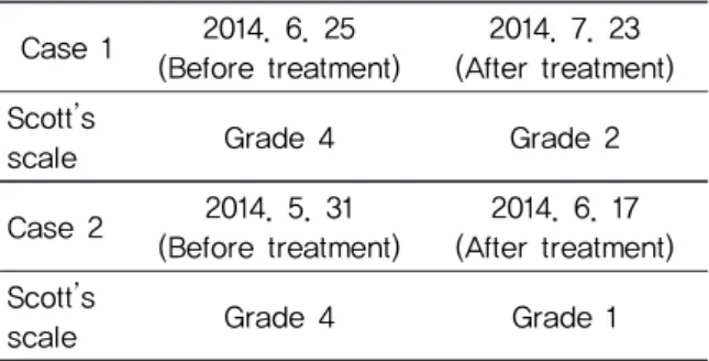 Table 6. Change of Scott’s Scale협부의 둔한 느낌도 호소하였으며 간헐적인 우측 안검 상하부에 경련이 나타나는데 심할 때는 타각적으로도 인지가 가능할 정도였다