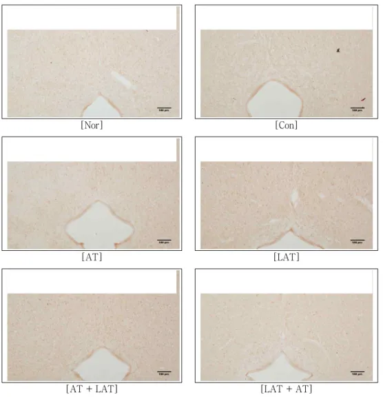 Fig.  5.  Representive  microphotographs  of  coronal  sections  for  observation  of  c-Fos  expression  in  central gray of brain of tibial and sural nerve injury rats