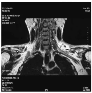 Fig. 1. C-spine MRI 2012. 06. 05