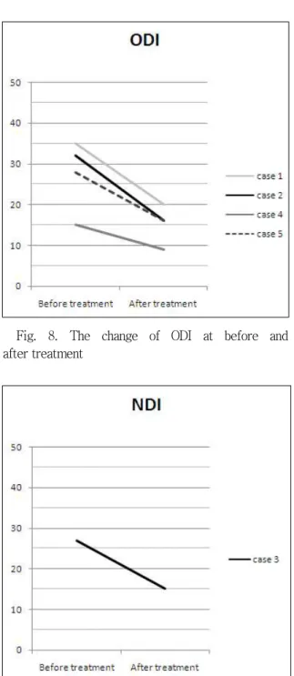 Fig.  8.  The  change  of  ODI  at  before  and  after treatment