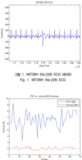 그림  2.  정상리듬과  PVC  리듬을  포함하는  QRS  Complex  구간별로  계산된  첨도치  (MIT/BIH_#228)  Fig.  2.  Kurtosis  for  MIT/BIH_#228  ECG  Database