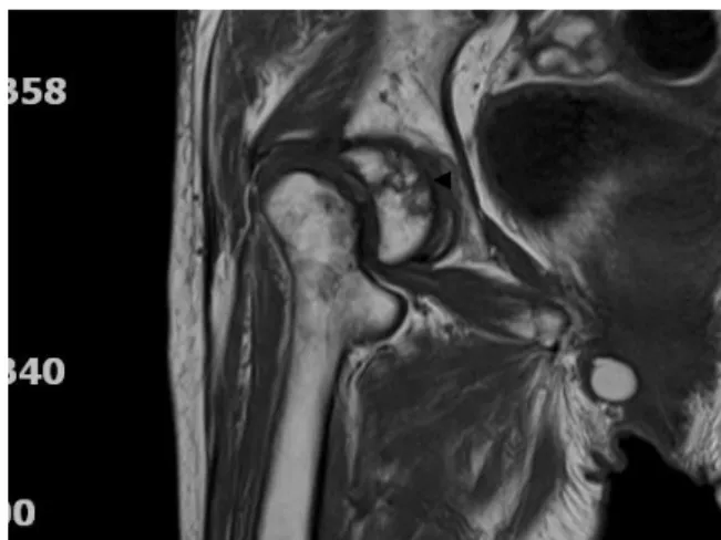 Fig. 5. The change of Harris hip score 