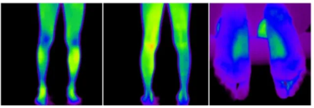 Fig. 5. DITI of lower extremity, outpatient de- de-partment 3 weeks