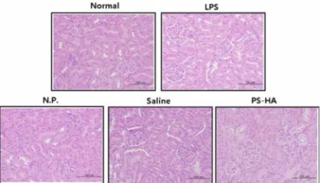 Fig. 13. Effects of PS-HA on total protein level  in urine of LPS-stimulated rats