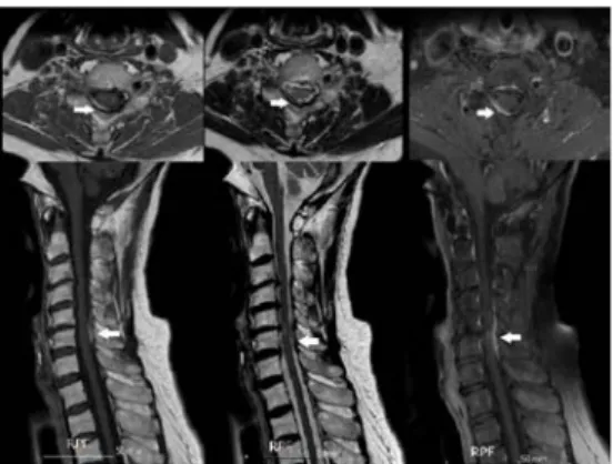 Fig. 2. MRI scan of C-spine (8) 치료 경과(Table 2)