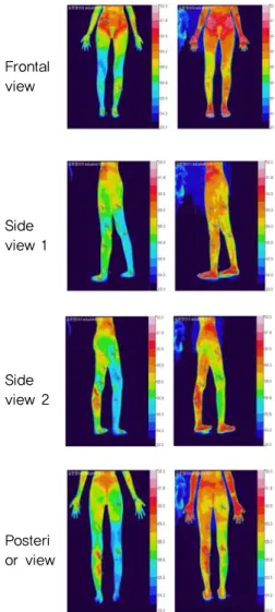Fig. 6. Change in DITI results of frontal view,  side-view 1, side-view 2, and posterior view