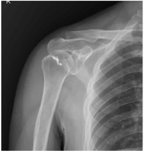 Fig. 1. Shoulder AP(Right)