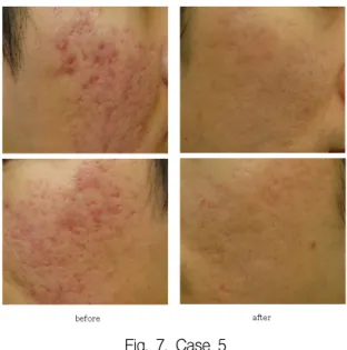 Fig.  7.  Case  5