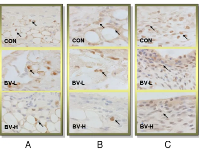 Table  4.  The  Image  Analysis  for  Inhibition  of  NF-kB  Activation  by  BV  Acupuncture(particles)으며,  봉독약침의  BV-L군이  1576±39particles,  BV-H군이  726±08particles로  대조군에  비하여  각각  유의성(p<0.05)  있는  억제를  나타내었다