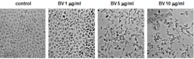 Table  2.  Effect  of  BV  on  NF-κB  activity  in  DU-145  Cells