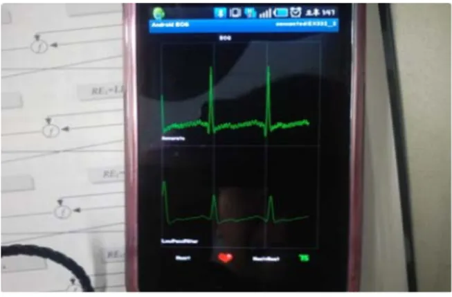 그림  8.  Android  Smart  Phone  실행화면 Fig.  8.  Run  Android  Smart  Phone  Screen