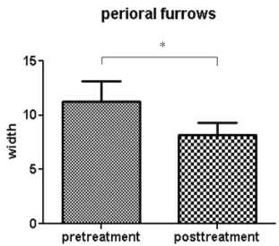 Table  1.  Measurement  Values  Before  and  After  one-time  Miso  Acupuncture  Treatment